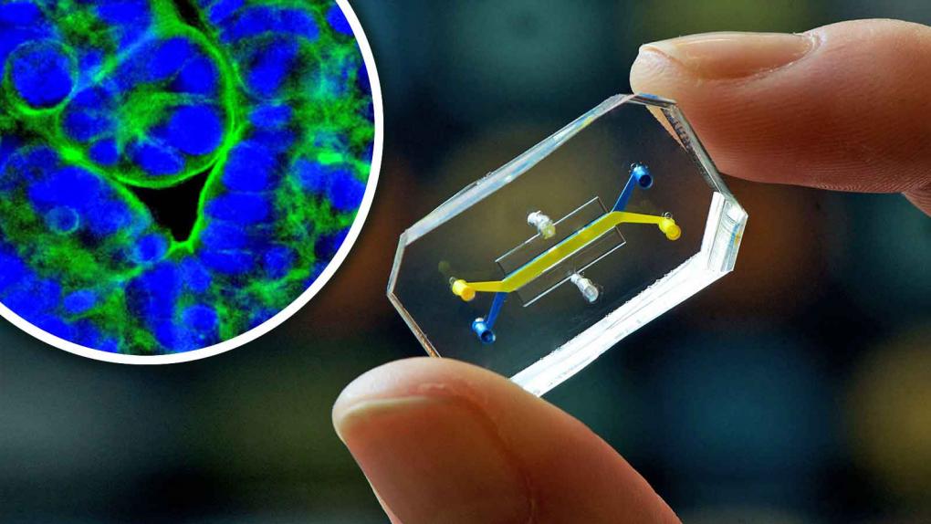 How effective are anti-radiation cellphone chips